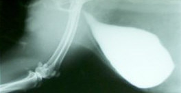 Röntgenfoto zand in blaas konijn 